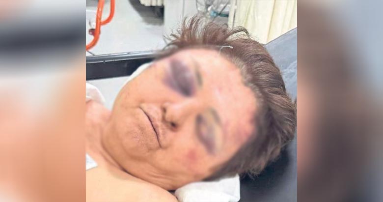 Cani gelinin yufka cinneti! Kayınvalidesini komaya soktu