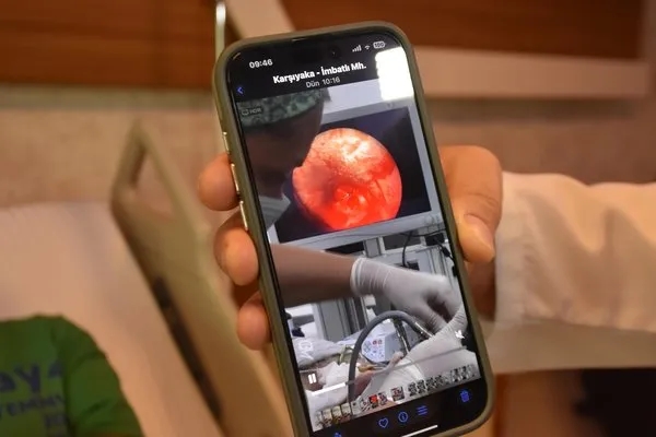 Öksürük şikayetiyle gitti! İmplant dişi akciğerine kaçmış