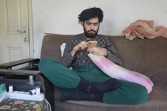 SON DAKİKA: Hatay’da deprem sonrası yaşama küsen Barış’tan sevindiren haber! Tırnaklarını kesmiyor banyo yapmıyordu...