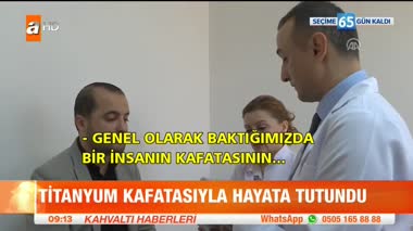 Titanyum kafatasıyla hayata tutundu